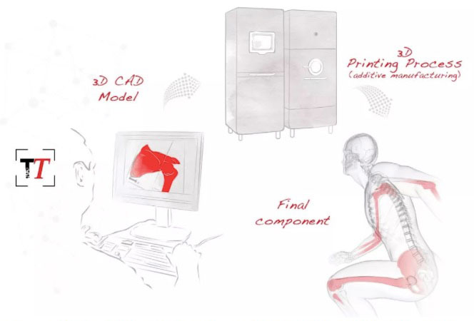 骨科3D打?。汗怩r外衣掩蓋下的骨感賽道