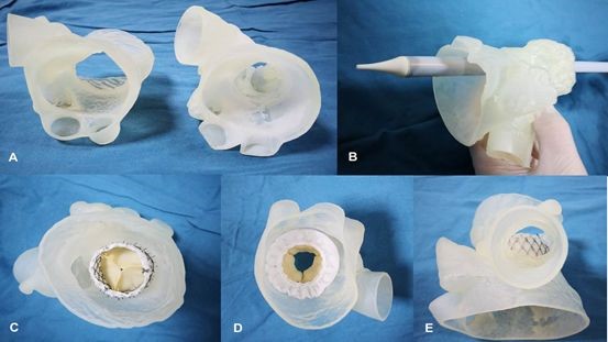 逐漸納入醫(yī)保范圍的3D打印模型，將會(huì)對(duì)醫(yī)工結(jié)合帶來(lái)哪些不同？